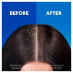 Head & Shoulders Classic Clean Clarifying Anti Dandruff Shampoo For Itchy, Dry Scalp And Hair-250ML