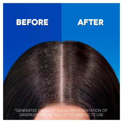 Head & Shoulders Citrus Fresh 2in1 Anti Dandruff Shampoo And Conditioner For Greasy Hair-330 ML
