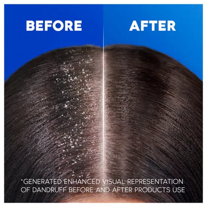 Head & Shoulders Smooth & Silky Anti-Dandruff Shampoo for Frizzy Hair-330ML